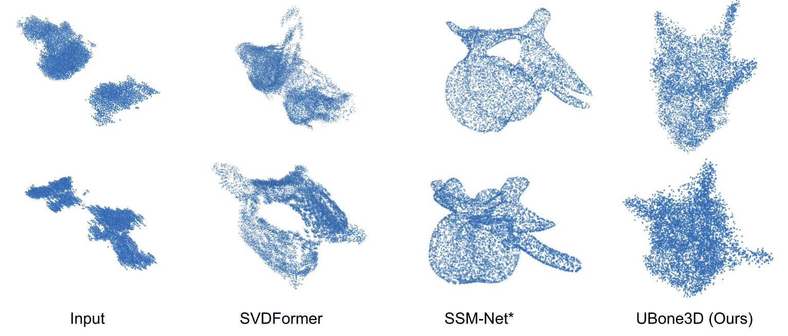 Qualitative comparison on in-vivo ultrasound point clouds: input, SVDFormer, SSM-Net* and UBone3D (ours).